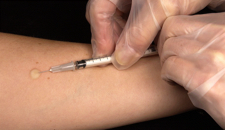 독감 무료 예방접종