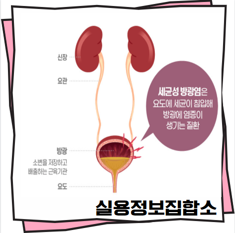 남자방광염증상