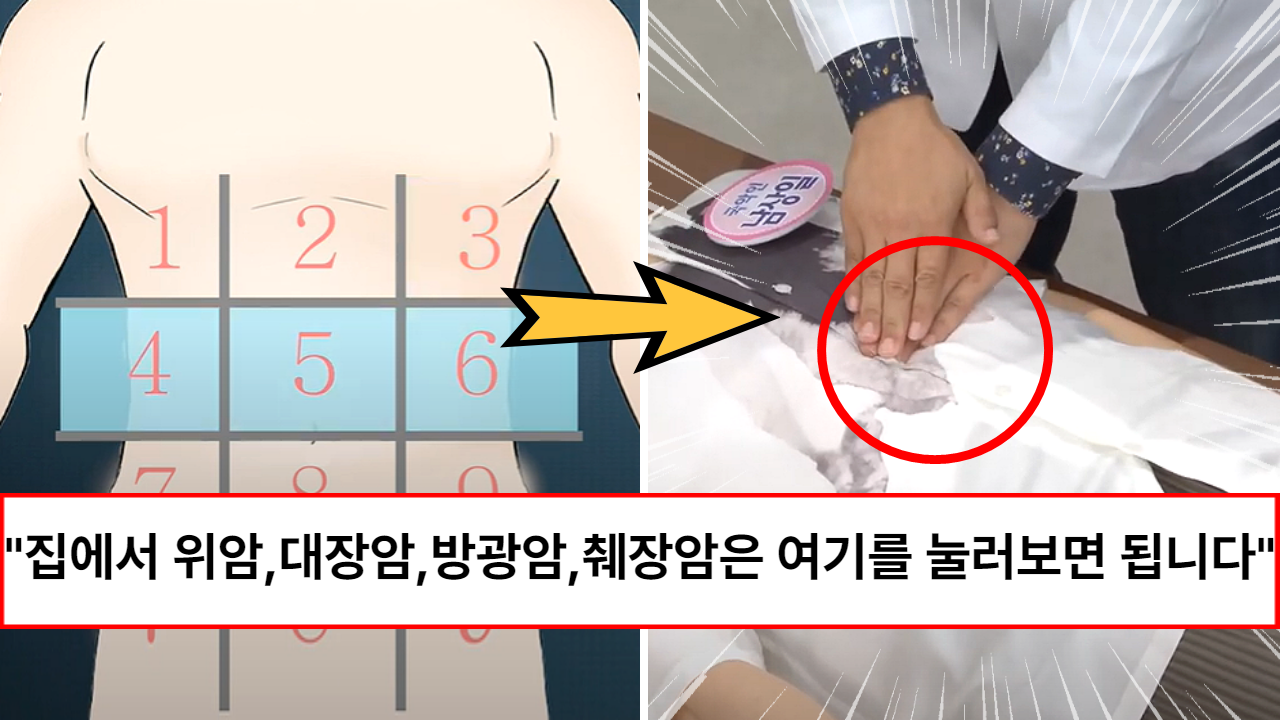 “매일 누르면 모든 암이 99% 예방됩니다” 각종 암이 자라고 있는지 집에서 스스로 할 수 있는 셀프내시경 방법 “매일 누르면 모든 암이 99% 예방됩니다” 각종 암이 자라고 있는지 집에서 스스로 할 수 있는 셀프내시경 방법