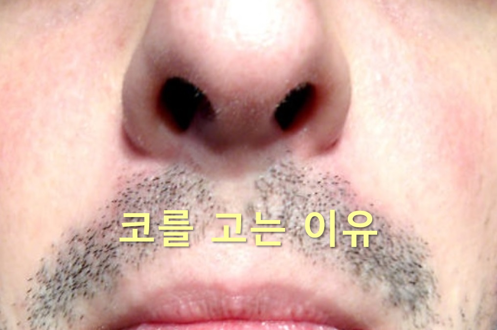  코를 고는 이유와 코골이 줄이는 방법