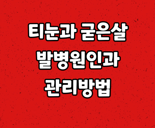  티눈과 굳은살 발병원인 및 관리방법