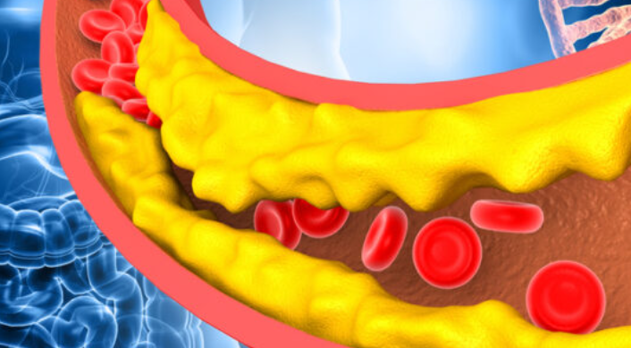 article thumbnail image