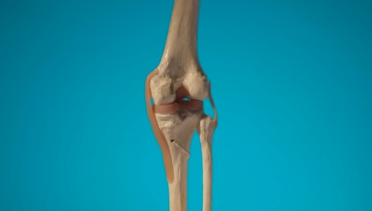 무릎관절-모형