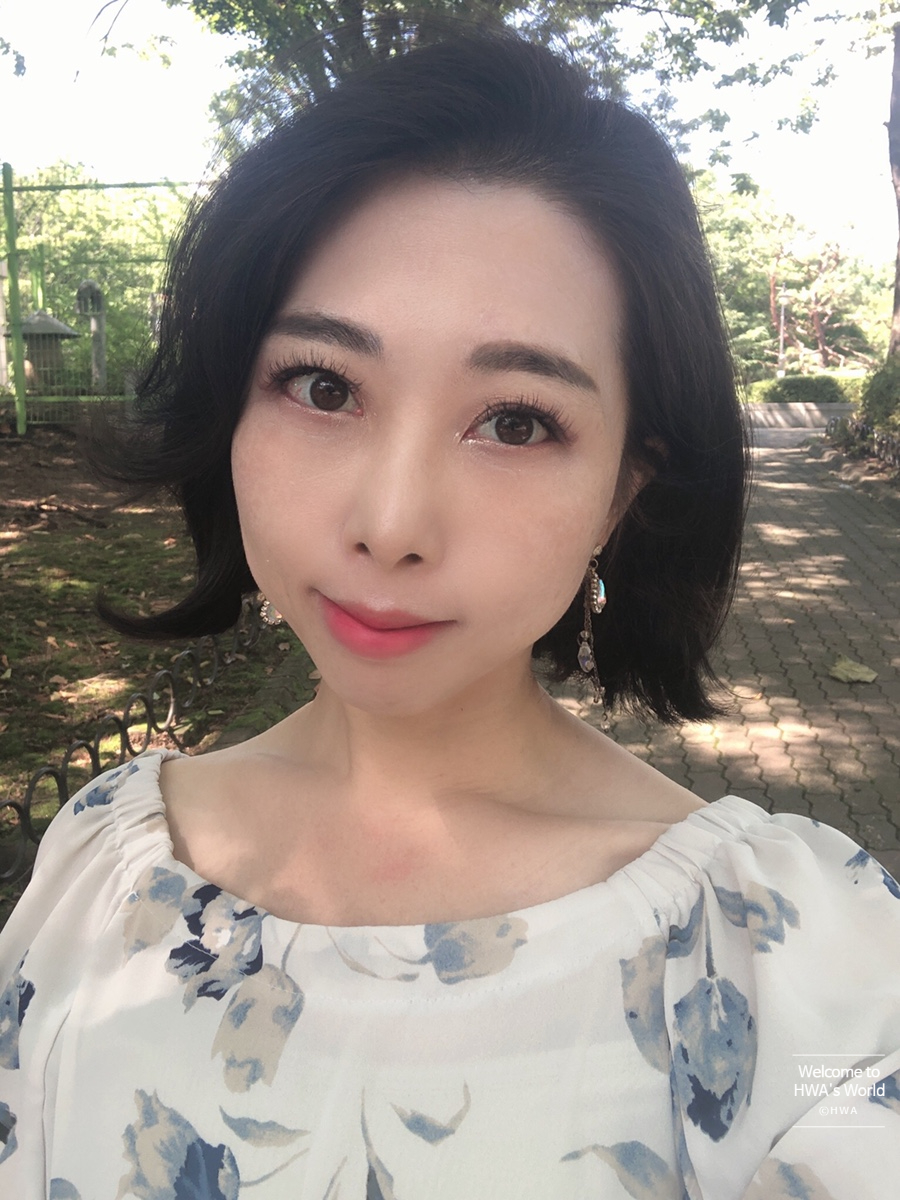 콧볼 축소 비용 [강남/보톡스] 콧볼축소주사-후기 19