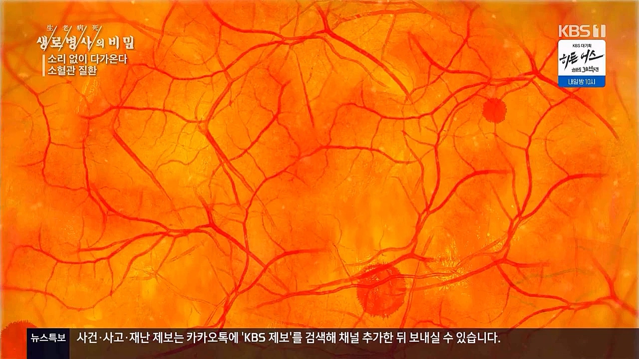 생로병사의비밀.E862.230309p.WANNA.mp4_20230309_194550.885.jpg