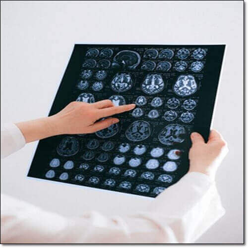 뇌동류 검사 MRI 및 CT 촬영