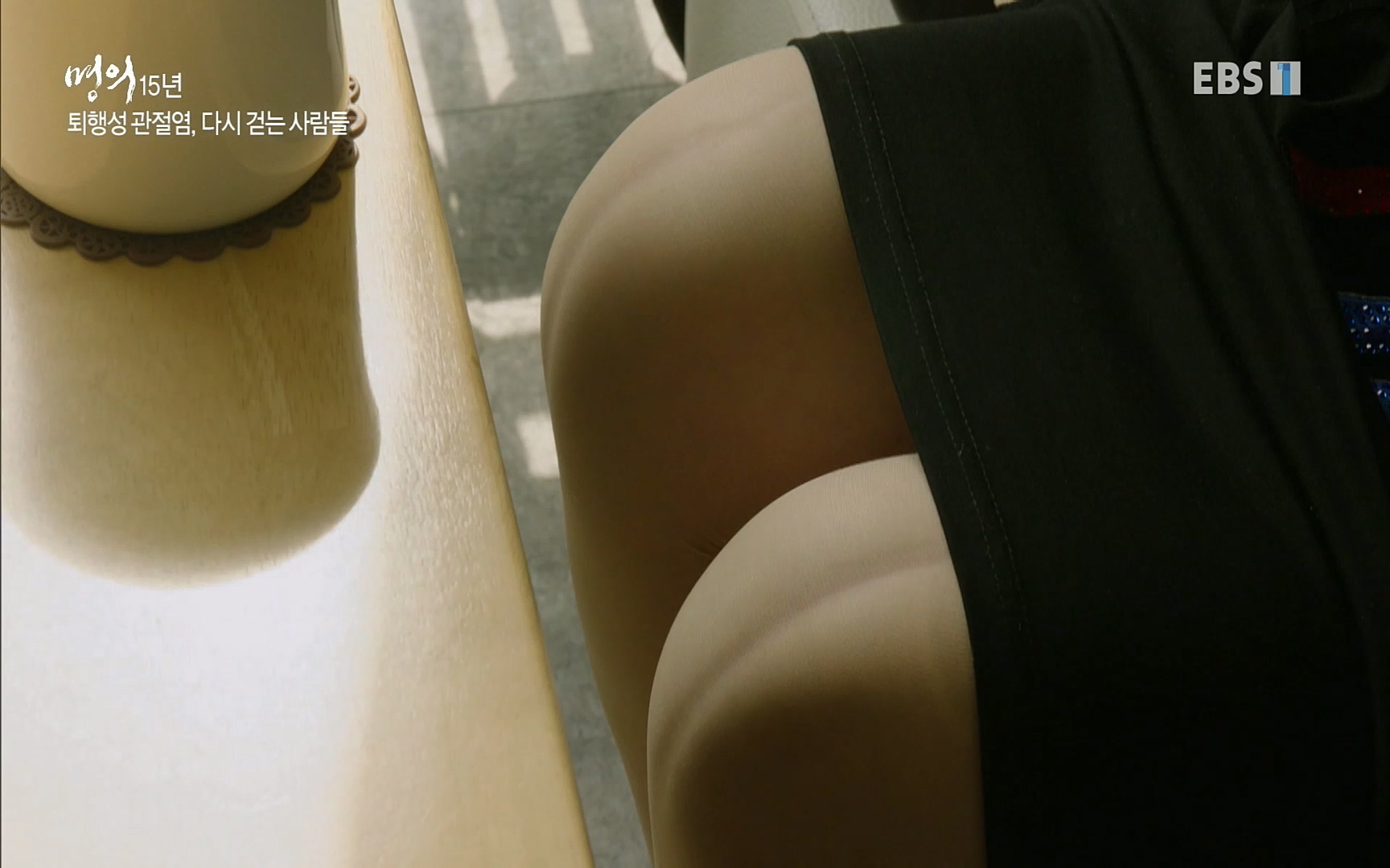 EBS 명의 헬스케어 - TV - 교육의 중심 EBS명의 15년 - 퇴행성관절염, 다시 걷는 사람들.mp4_20220803_212701.215.jpg