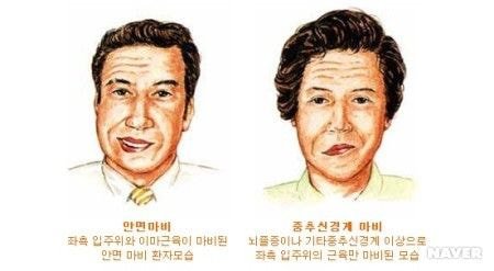  가능한 빨리 응급실 안가면 후회하는 질환.