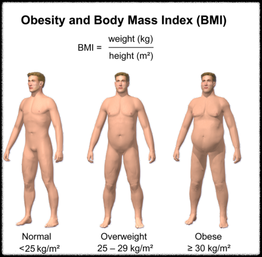BMI-30-남자