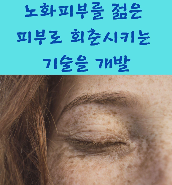  노화피부를 젊은 피부로 회춘시키는 기술을 개발?