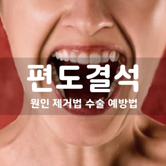 편도결석 제거 올바른 방법 5가지, 예방법은?