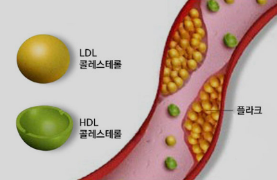 콜레스테롤 낮추는 방법 이렇게 해보세요~