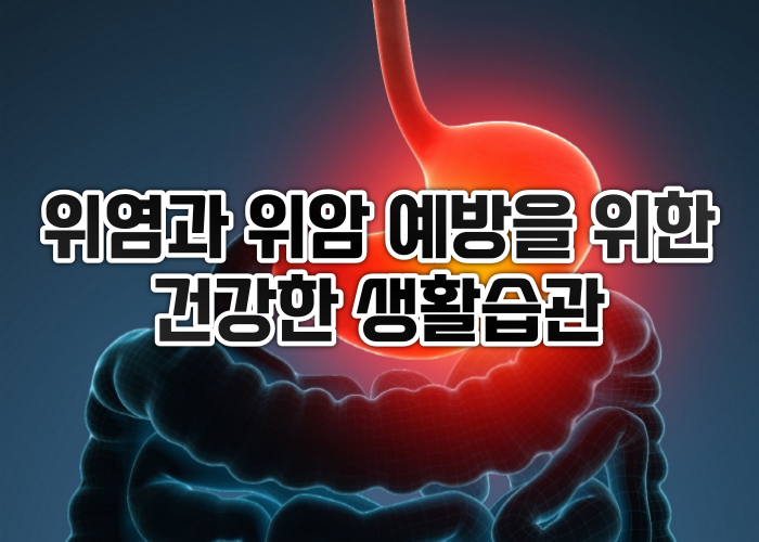  위염과 위암 예방을 위한 건강한 생활습관