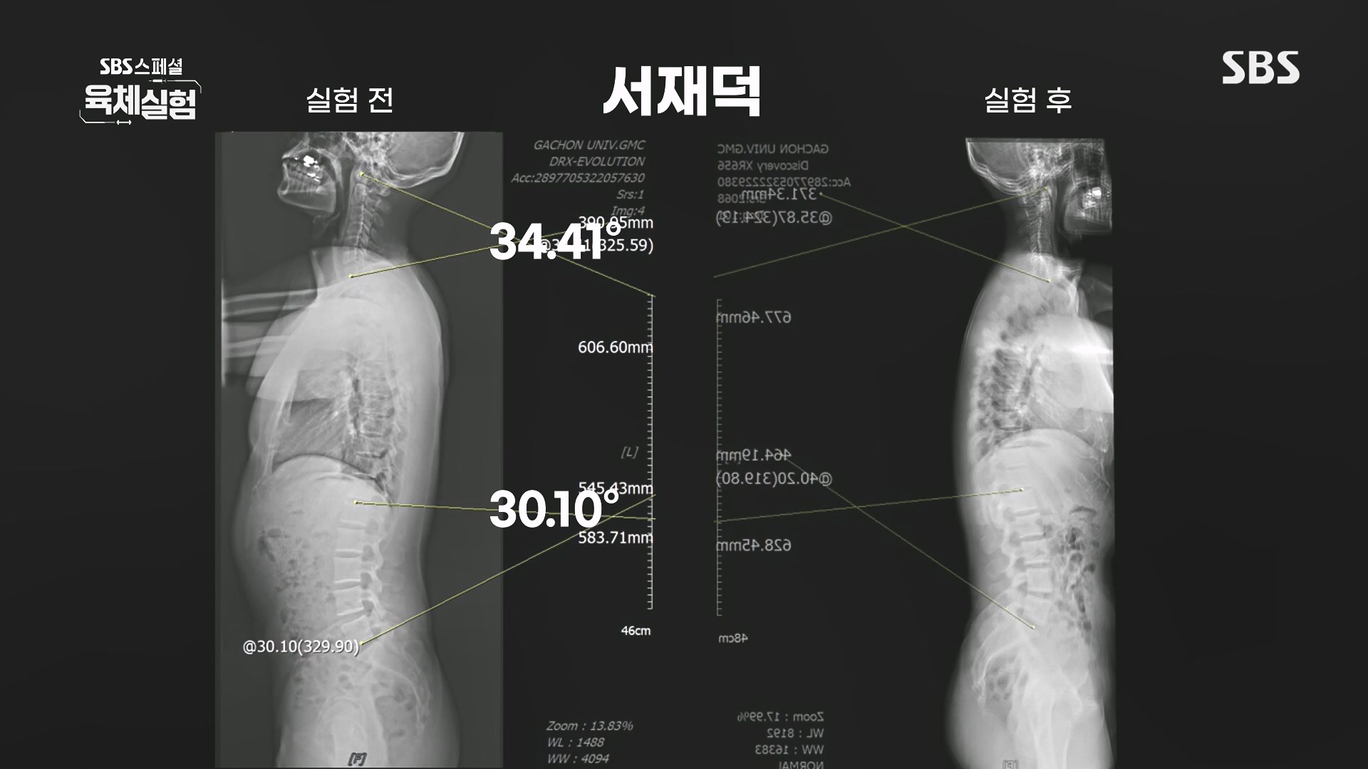 SBS 스페셜.E655.231015p.H264-F1RST.mp4_20231016_203710.354.jpg
