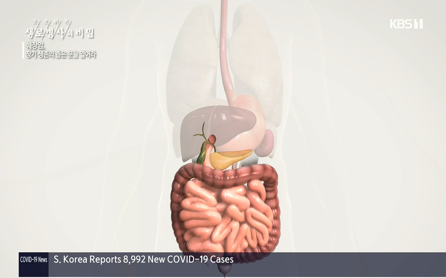 생로병사의 비밀.E823.220622p.H264-F1RST.mp4_20220624_210514.056.jpg