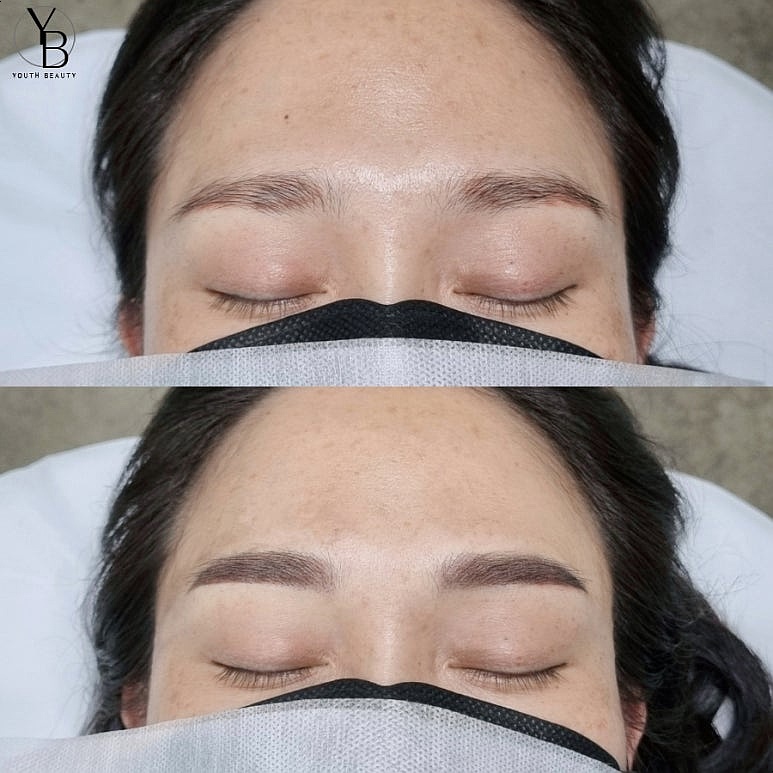  광주 눈썹문신 잘하는곳 새빨간 잔흔 커버