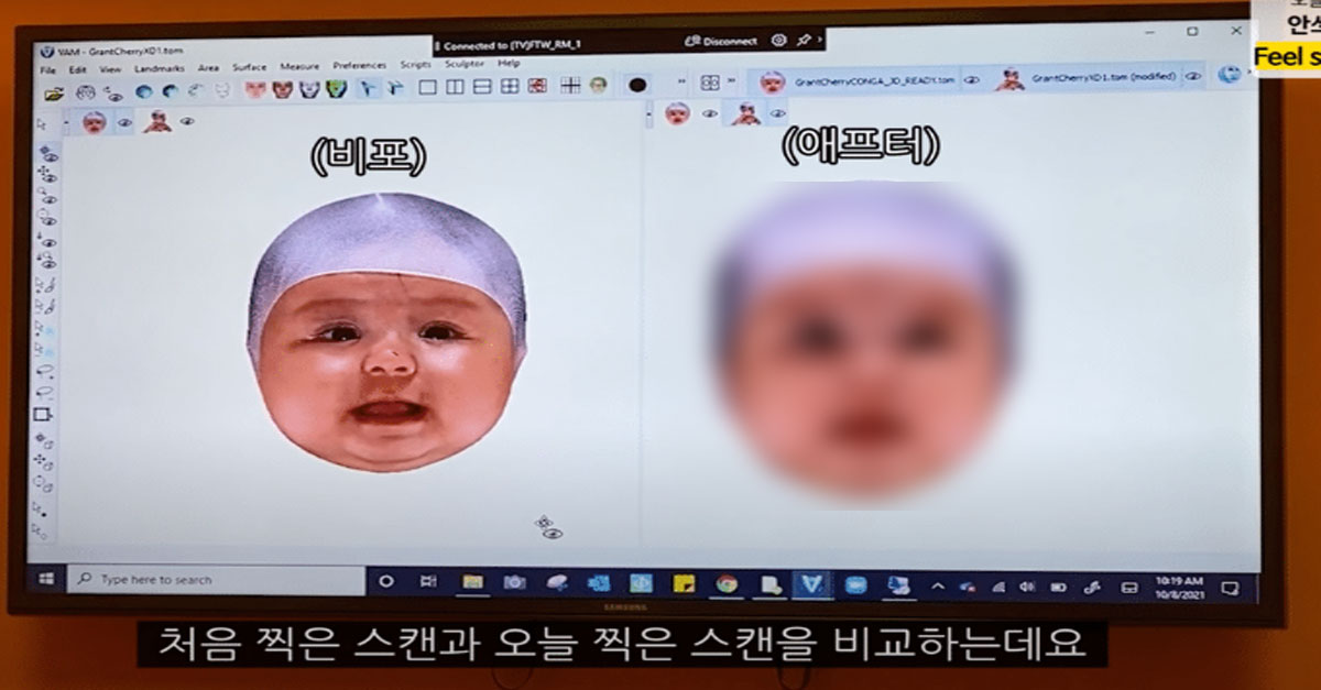  논란 있었던 올리버쌤 아기 교정 헬멧 후기