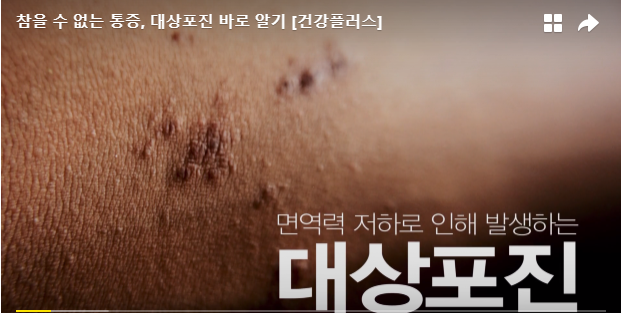  대상포진 병원 초기 증상 예방 좋은 음식 치료 방법