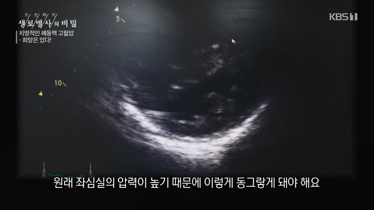 생로병사의 비밀.E900.240215p-NEXT.mp4_20240215_202858.259.jpg