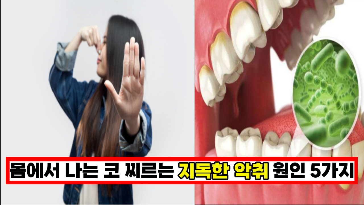  '몸에서 코 찌르는 냄새가' 몸에서 나는 지독한 악취 원인 5가지