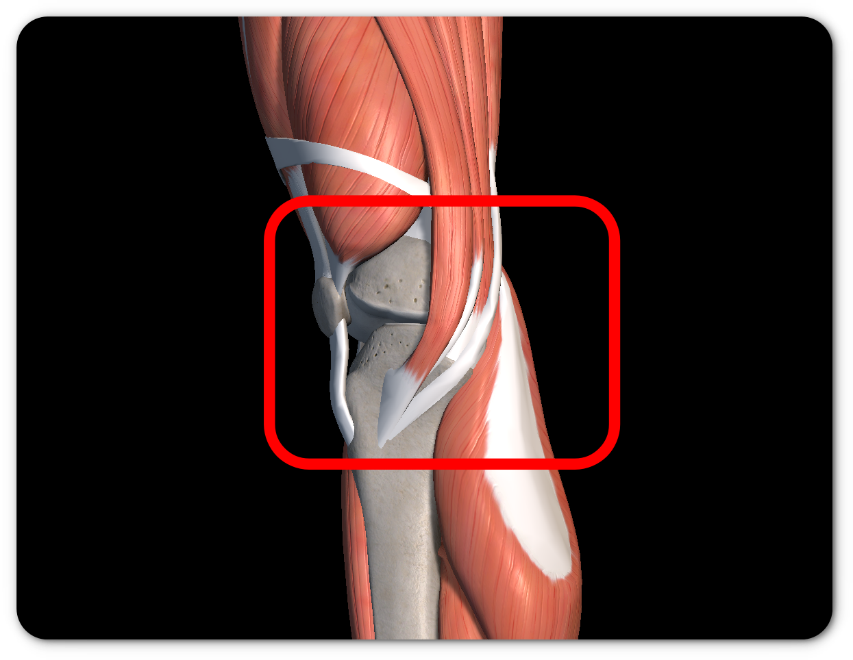 무릎 안쪽 통증 원인
