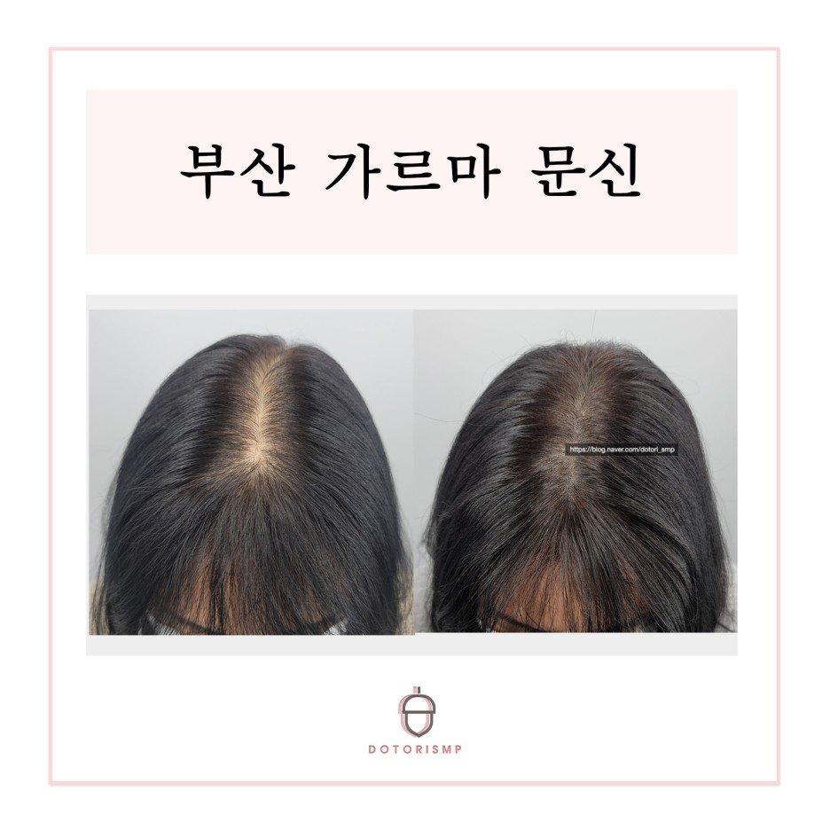  부산 가르마 문신 잘하는곳