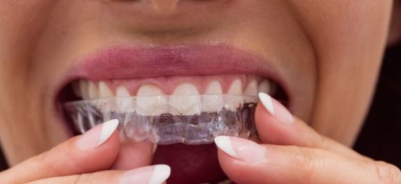 인비절라인 선택이유 (개인적인 후기,가격)