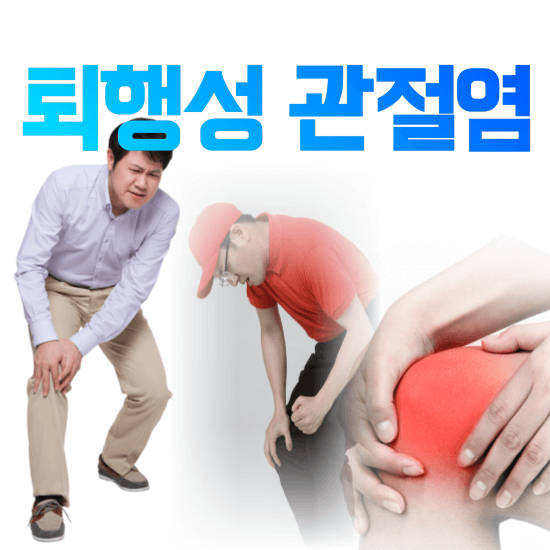 무릎통증 구부릴때 통증 무릎 소리 염증