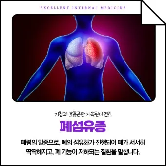폐섬유증 초기 증상 치료법 관리방법_16
