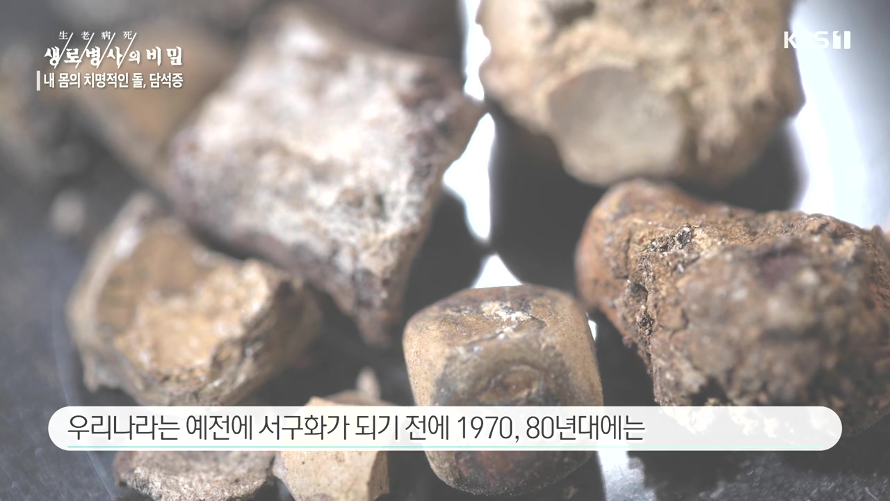 생로병사의 비밀.E886.231019p-NEXT.mp4_20231019_201809.277.jpg