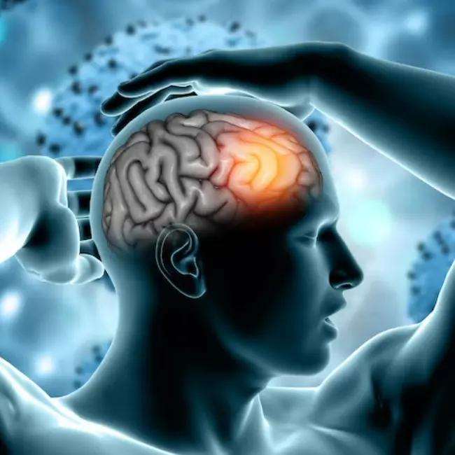 뇌종양으로-인한-두통은-일반-두통과-차이가-있습니다.