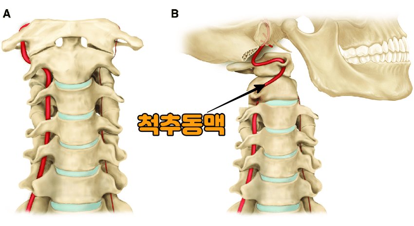 왼쪽 뒤통수의 심한 두통을 어떻게 극복하는지 3