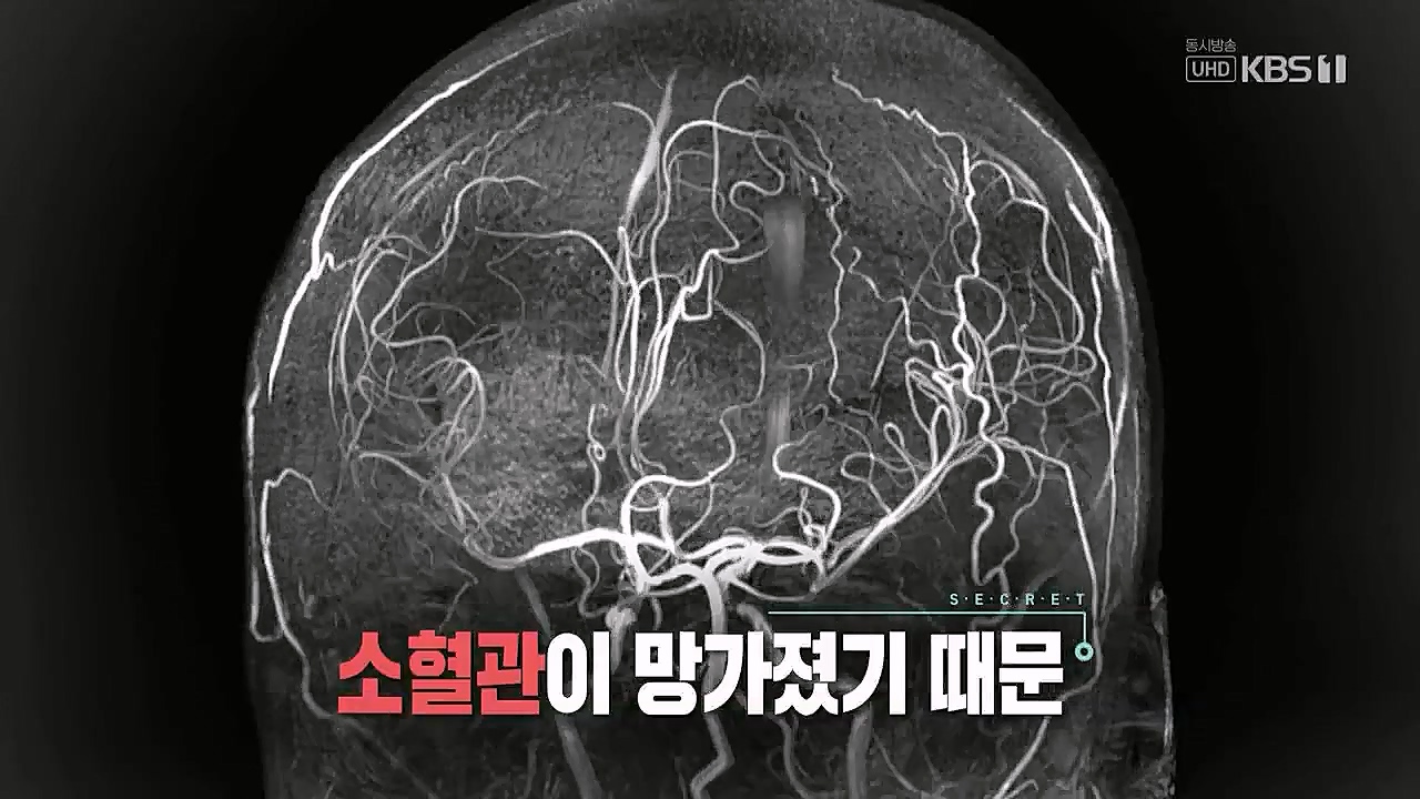생로병사의비밀.E862.230309p.WANNA.mp4_20230309_191952.083.jpg