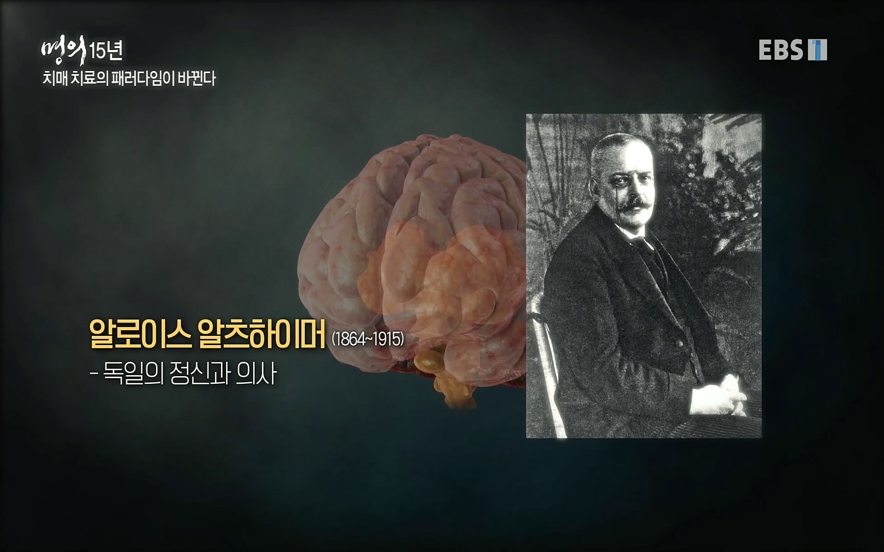 EBS 명의 헬스케어 - TV - 교육의 중심 EBS명의 15년 치매 치료의 패러다임이 바뀐다.mp4_20220808_204731.754.jpg