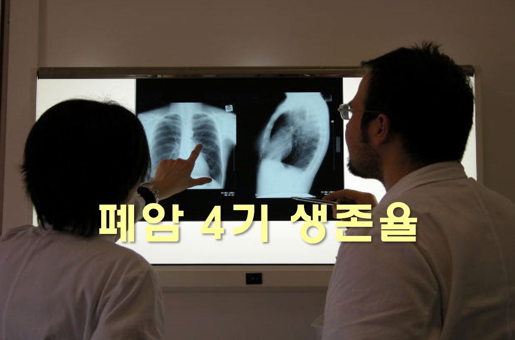  폐암 4기 생존기간과 폐암 4기 생존율