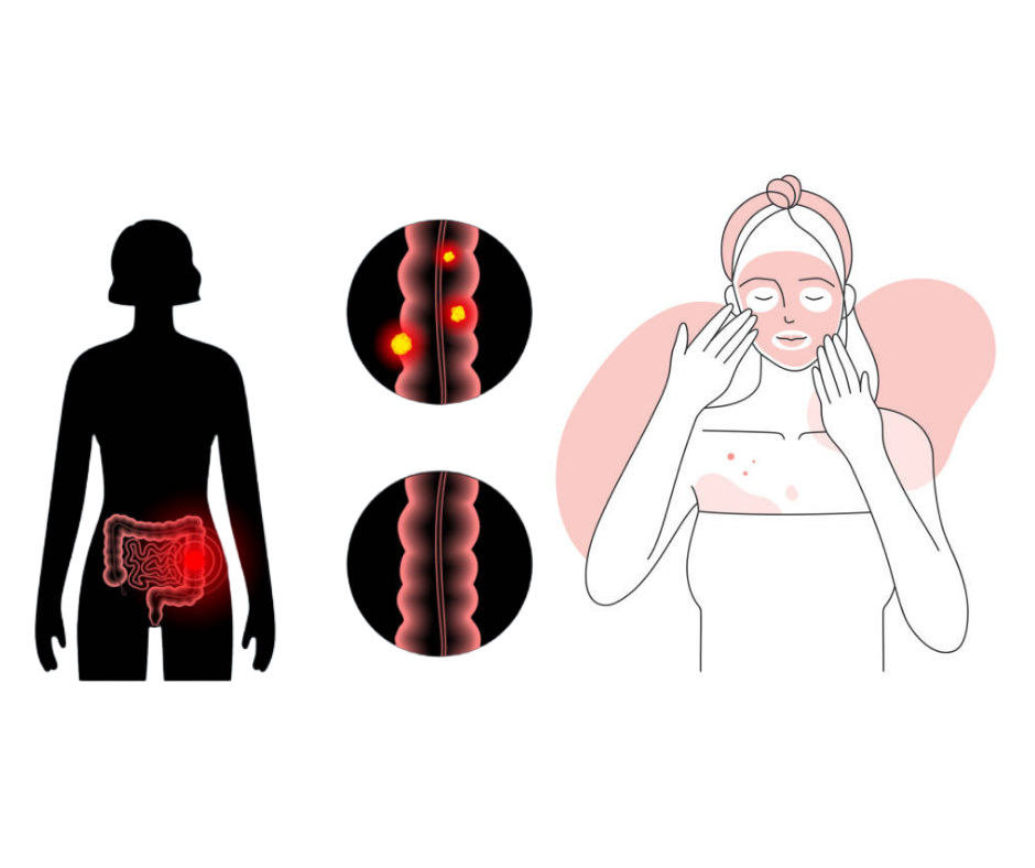 블루베리 효능 항암작용 및 피부 건강