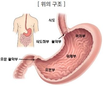 위축성 위염 증상