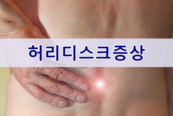  허리디스크, 증상과 운동법