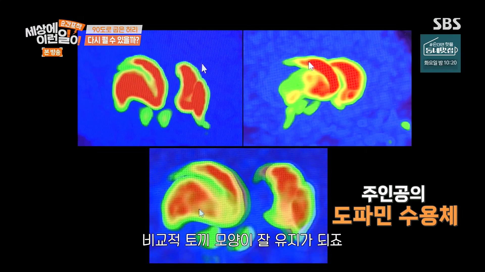 순간포착 세상에 이런일이.E1245.230909p.H264-F1RST.mp4_20230910_165453.319.jpg