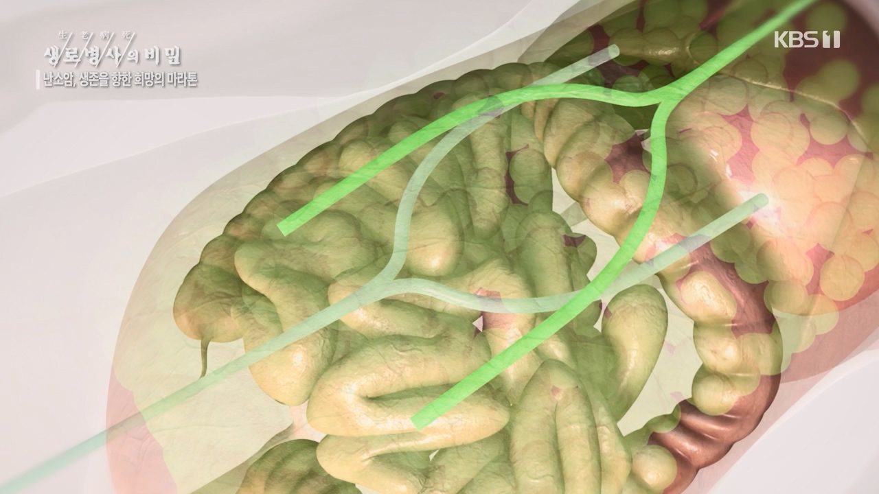 생로병사의 비밀.E878.230803p-NEXT.mp4_20230805_155635.837.jpg