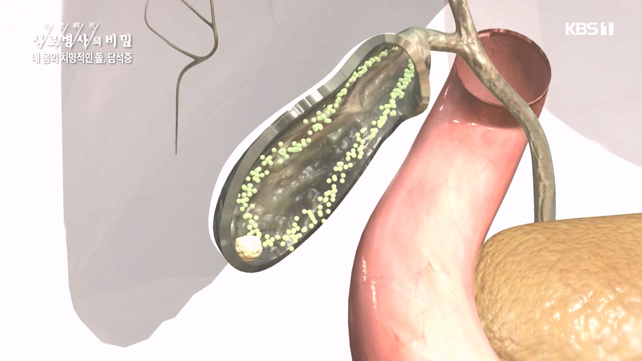 생로병사의 비밀.E886.231019p-NEXT.mp4_20231019_203444.525.jpg