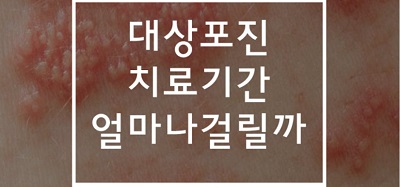 대상포진-치료기간-포스터