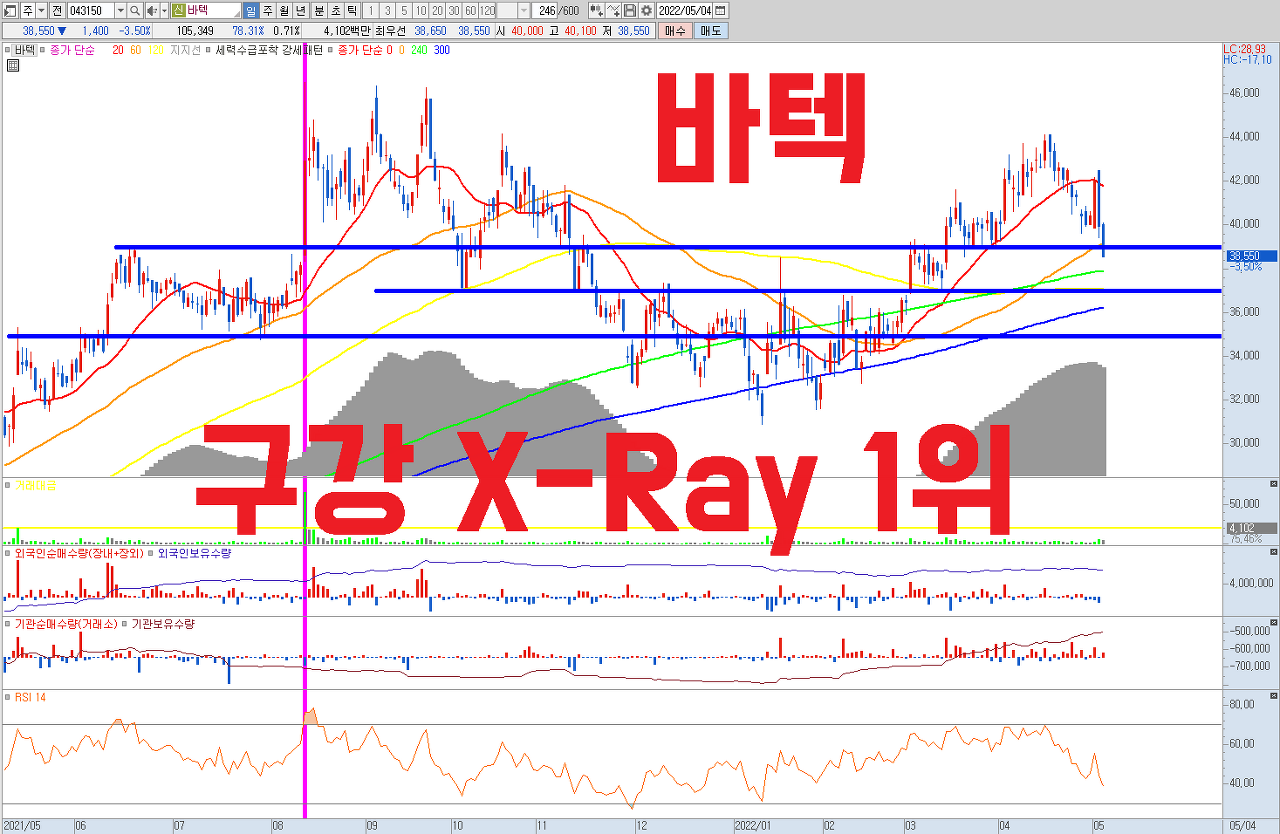  바텍 주식 전망 | 글로벌 1위 구강 X-Ray 브랜드 | 덴탈 전문 업체 , 사상 최대 실적 전망 | 안정적인 재무구조와 저PER 매력을 보유하고 있는 저평가우량주 | 23년 P/E 8배