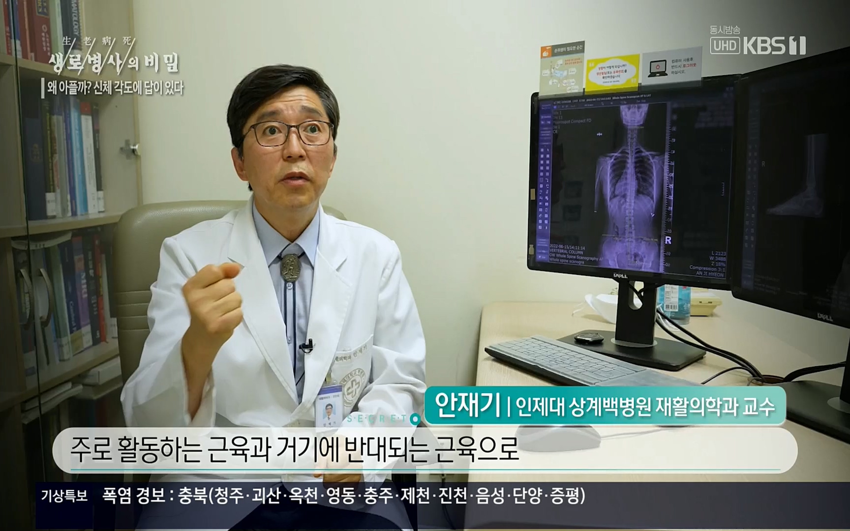 생로병사의 비밀.E825.220706p.H264-F1RST.mp4_20220707_185752.604.jpg