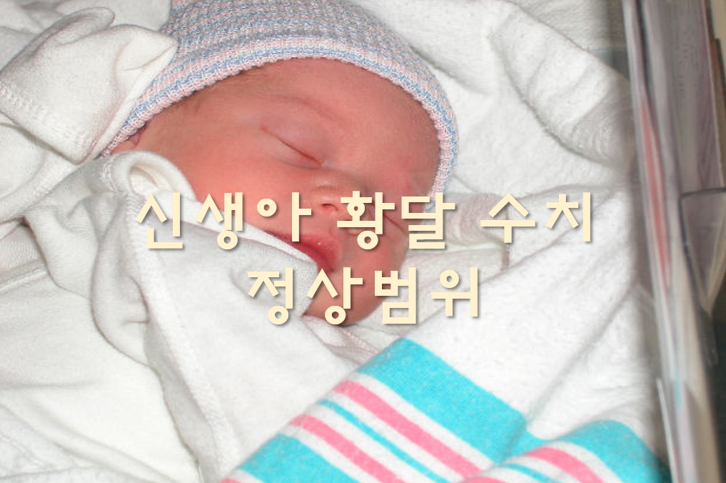  신생아 황달 수치 정상범위와 치료 방법