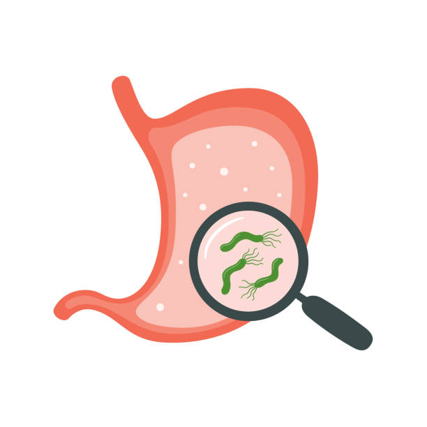 헬리코박터균 치료 꼭 필요할까요?