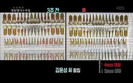 [670회] 생로병사의 비밀 - KBS670회] 생로병사의 비밀.ts_20220505_143215.091.jpg