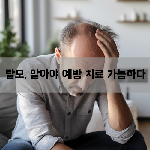 탈모 원인 치료 예방법