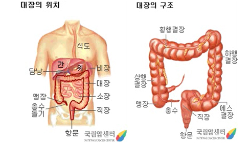  대장암을 예방하고 도움이 되는 유익한 음식 7가지.