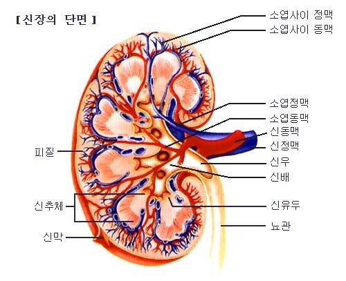 급성 신우신염 증상